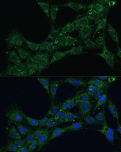 ETFB Rabbit Polyclonal Antibody (CAB16043)