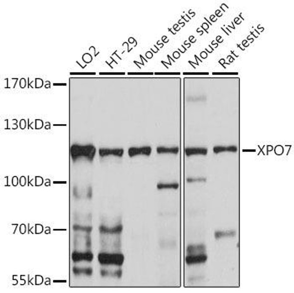 XPO7 Rabbit Polyclonal Antibody (CAB16108)