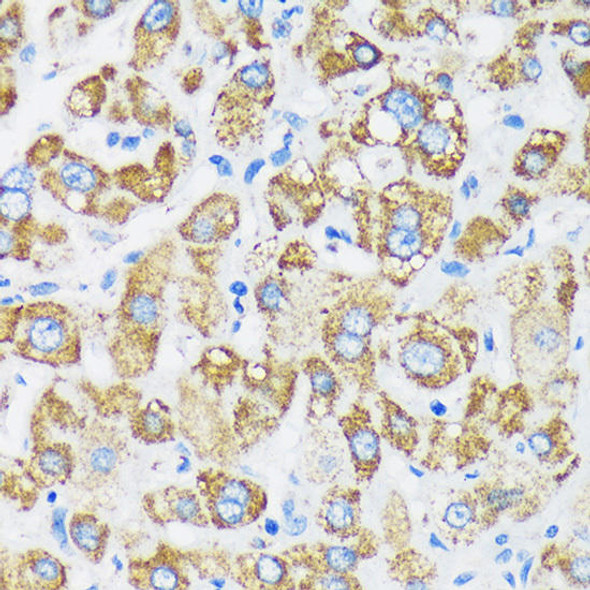 GTPBP8 Rabbit Polyclonal Antibody (CAB16189)