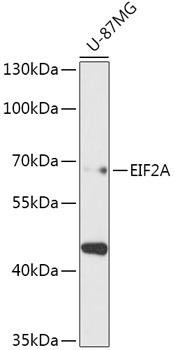 eIF2A Rabbit Polyclonal Antibody (CAB16205)