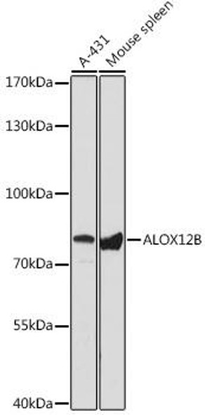 ALOX12B Rabbit Polyclonal Antibody (CAB16210)