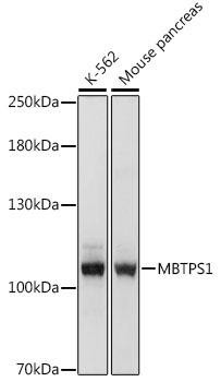 MBTPS1 Rabbit Polyclonal Antibody (CAB16243)