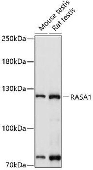 RASA1 Rabbit Polyclonal Antibody (CAB1634)