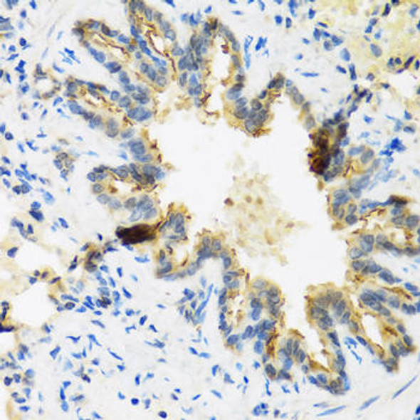 DEFB4A Rabbit Polyclonal Antibody (CAB1643)