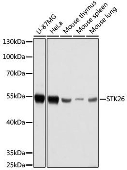 STK26 Rabbit Polyclonal Antibody (CAB16534)