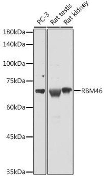RBM46 Rabbit Polyclonal Antibody (CAB16605)