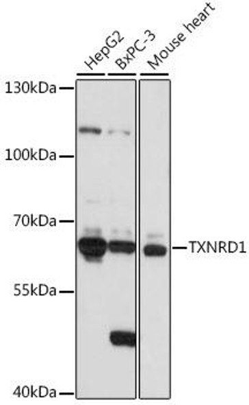 Thioredoxin reductase 1 (TXNRD1 ) Rabbit Polyclonal Antibody (CAB16631)