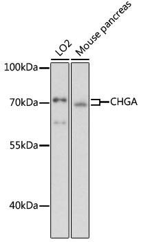 CHGA Rabbit Polyclonal Antibody (CAB1668)