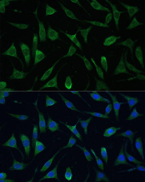 LSM14A Rabbit Polyclonal Antibody (CAB16682)