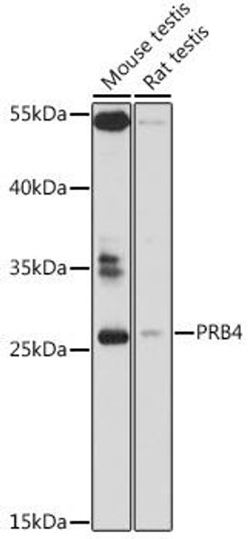 PRB4 Rabbit Polyclonal Antibody (CAB16702)