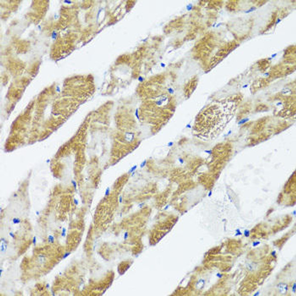 CASQ2 Rabbit Polyclonal Antibody (CAB16797)