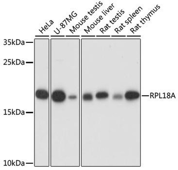 RPL18A Rabbit Polyclonal Antibody (CAB16967)