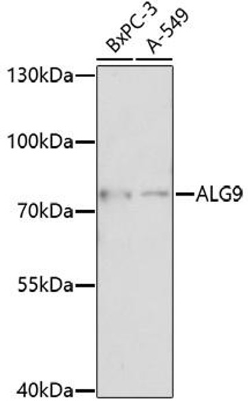 ALG9 Rabbit Polyclonal Antibody (CAB17213)