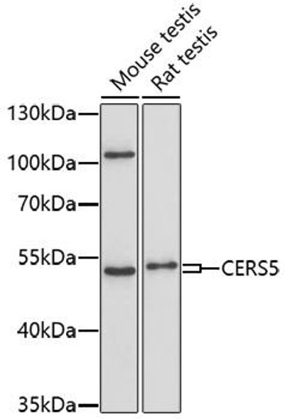CERS5 Rabbit Polyclonal Antibody (CAB17239)