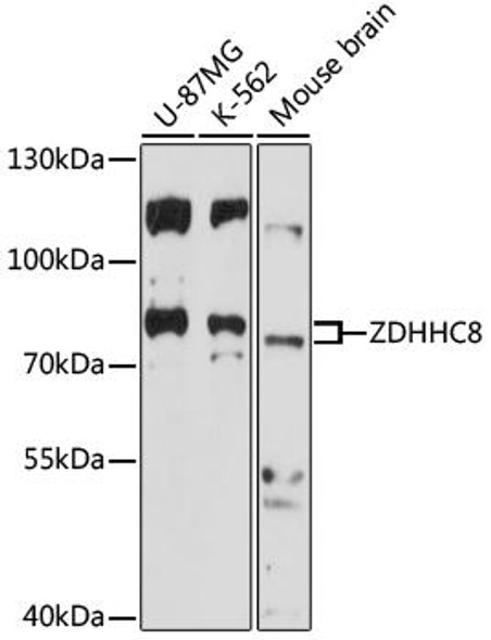 ZDHHC8 Rabbit Polyclonal Antibody (CAB17348)