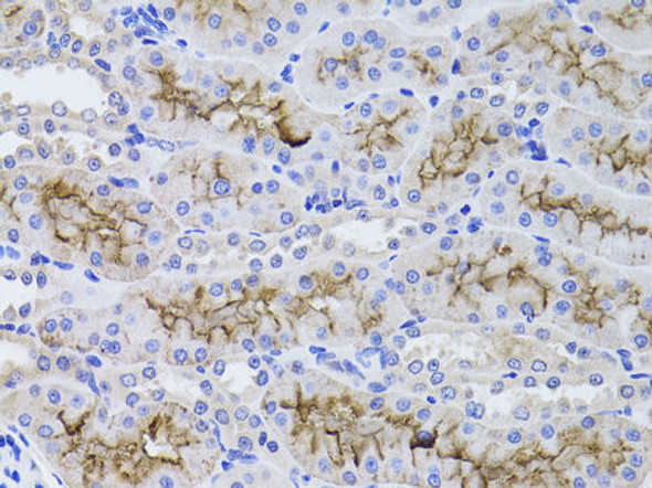 GGT1 Rabbit Polyclonal Antibody (CAB1776)
