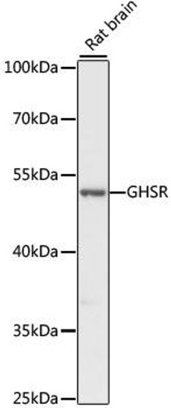 GHSR Rabbit Polyclonal Antibody (CAB1840)