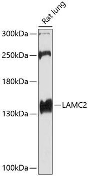 LAMC2 Rabbit Polyclonal Antibody (CAB1869)