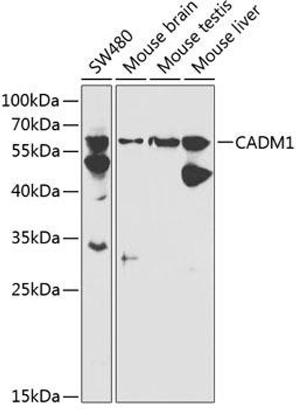 CADM1 Rabbit Polyclonal Antibody (CAB1892)