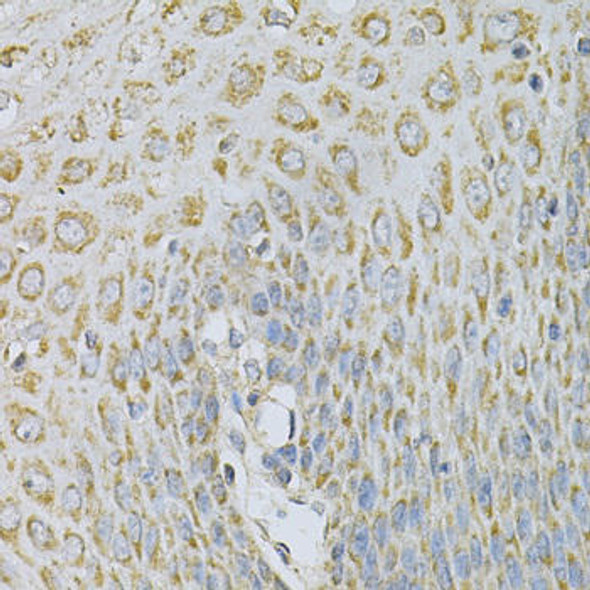 AP2B1 Rabbit Polyclonal Antibody (CAB1995)