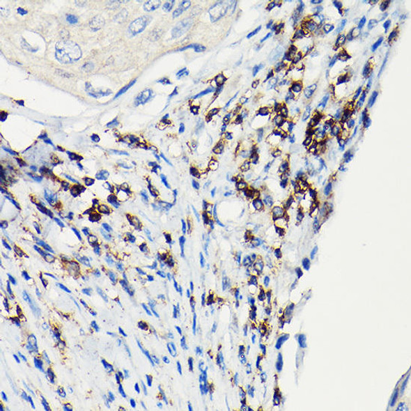 CD3H Rabbit Polyclonal Antibody (CAB2058)