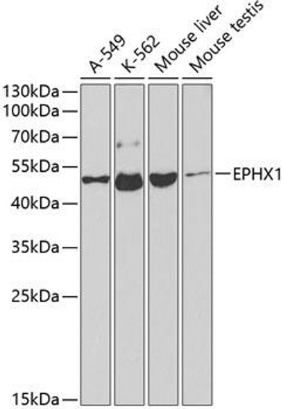 EPHX1 Rabbit Polyclonal Antibody (CAB2070)