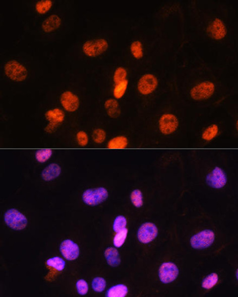 FANCD2 Rabbit Polyclonal Antibody (CAB2072)