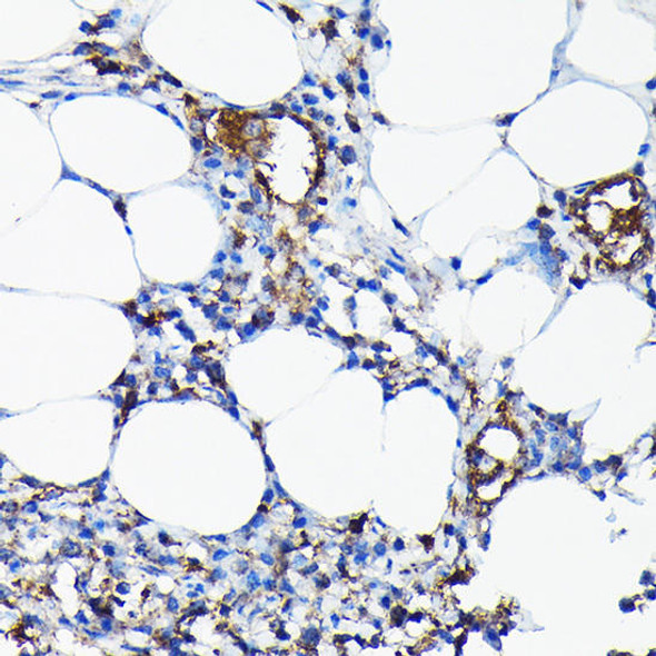 CYP1A1 Rabbit Polyclonal Antibody (CAB2159)
