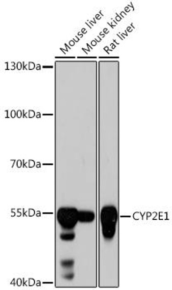 CYP2E1 Rabbit Polyclonal Antibody (CAB2160)