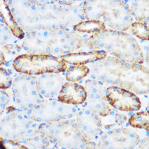 SELE Rabbit Polyclonal Antibody (CAB2191)