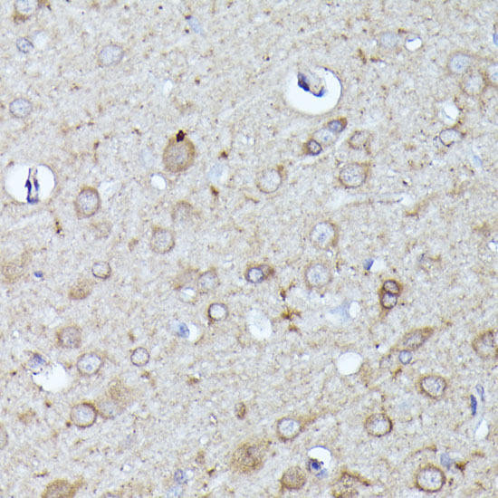 Cell Cycle Antibodies 1 Anti-N-WASP Antibody CAB2576