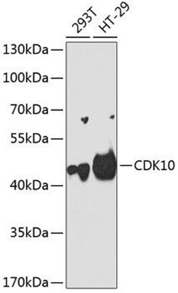 CDK10 Rabbit Polyclonal Antibody (CAB2690)