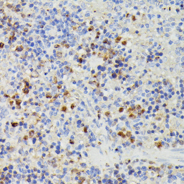 DUT Rabbit Polyclonal Antibody (CAB2901)