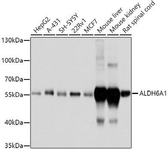 ALDH6A1 Rabbit Polyclonal Antibody (CAB3309)