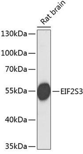 EIF2S3 Rabbit Polyclonal Antibody (CAB3848)