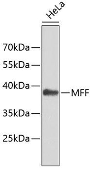 MFF Rabbit Polyclonal Antibody (CAB4874)