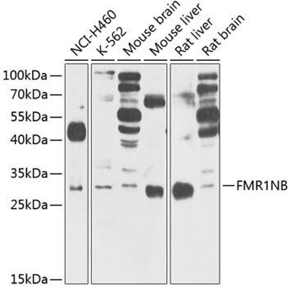 FMR1NB Rabbit Polyclonal Antibody (CAB5183)