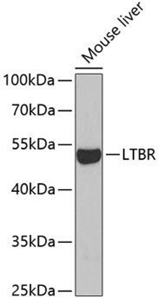LTBR Rabbit Polyclonal Antibody (CAB5351)