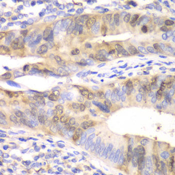 UBE2C Rabbit Polyclonal Antibody (CAB5499)