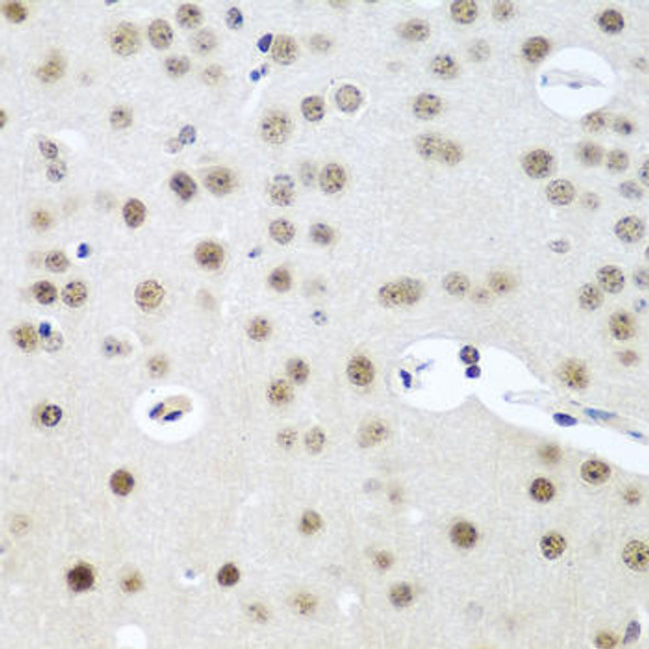 UTP14A Rabbit Polyclonal Antibody (CAB5960)