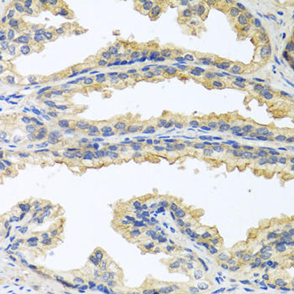 Oncostatin M Rabbit Polyclonal Antibody (CAB6163)