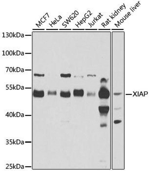 [KO Validated] XIAP Rabbit Polyclonal Antibody (CAB6869)