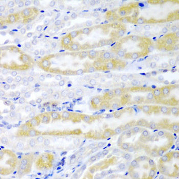FABP6 Rabbit Polyclonal Antibody (CAB6906)