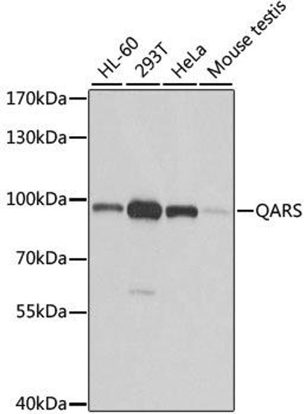 QARS Rabbit Polyclonal Antibody (CAB6960)