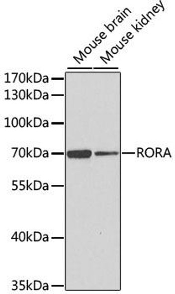 RORA Rabbit Polyclonal Antibody (CAB6971)