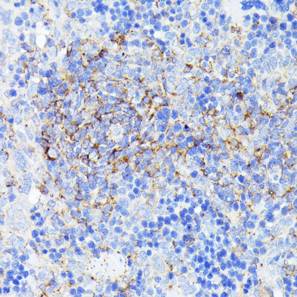 SMYD4 Rabbit Polyclonal Antibody (CAB7310)