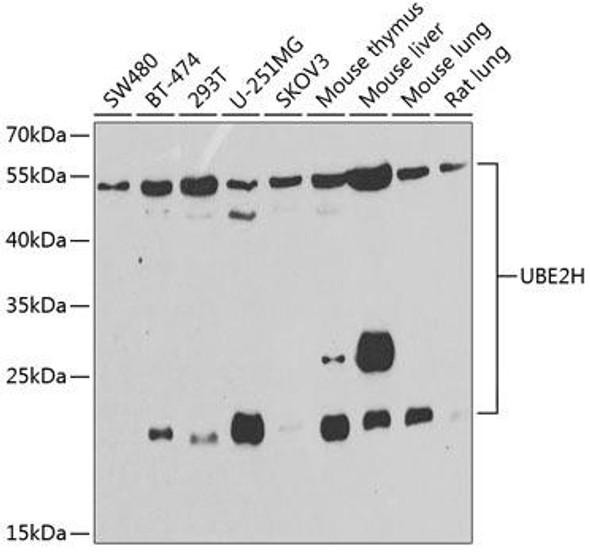 UBE2H Rabbit Polyclonal Antibody (CAB7344)