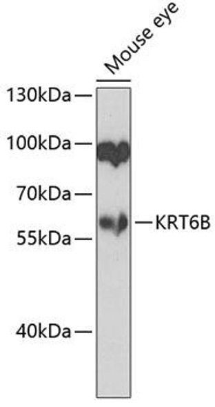 KRT6B Rabbit Polyclonal Antibody (CAB7696)