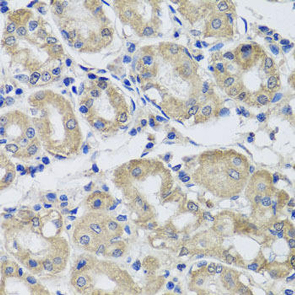 ST8SIA2 Rabbit Polyclonal Antibody (CAB7748)