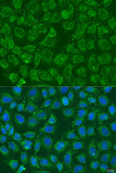PIP5K1B Rabbit Polyclonal Antibody (CAB7749)